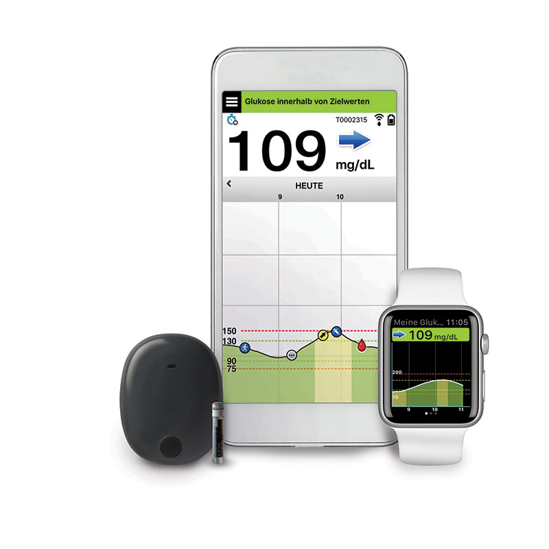 Eversense E3 Transmitter und Sensor mit Smartphone und Smartwatch